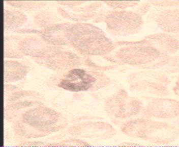 Neutrofils image, received from a microscope