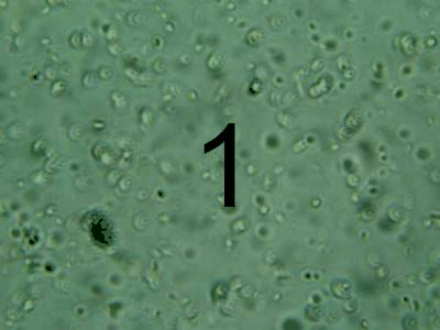 Results were made using a microscope