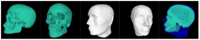 Figure 3: VRML models of the segmented CT scanned data (skull, skin and both)