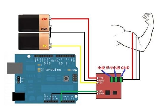  Figure 2 – Connecting electromyographic sensor.