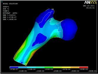 Figure 5  Elastic strains in a thigh bone when applying the load to its spherical part. 