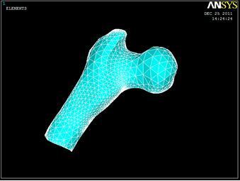 Figure 6 - A thigh bone model in ANSYS medium 