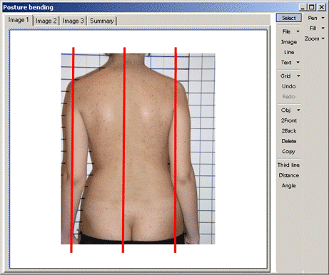 Figure 3 2 vertical marker line on the photo 1