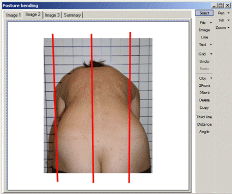 Figure 3 3 Vertical marker lines on the photo 2