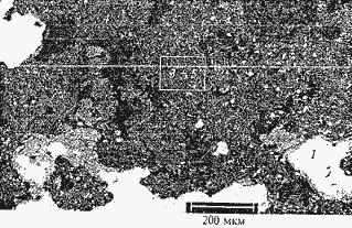 Рисунок 2 – Микроструктура отложений на стенке канала погружаемого стакана